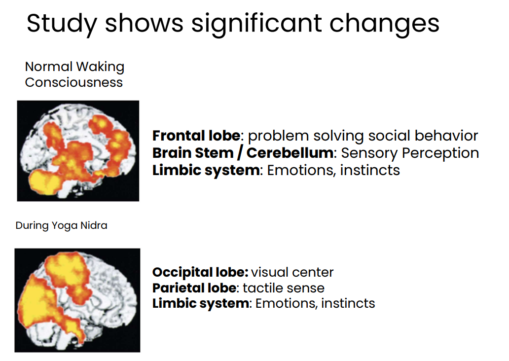 Courtesy of LoveYourBrain Foundation